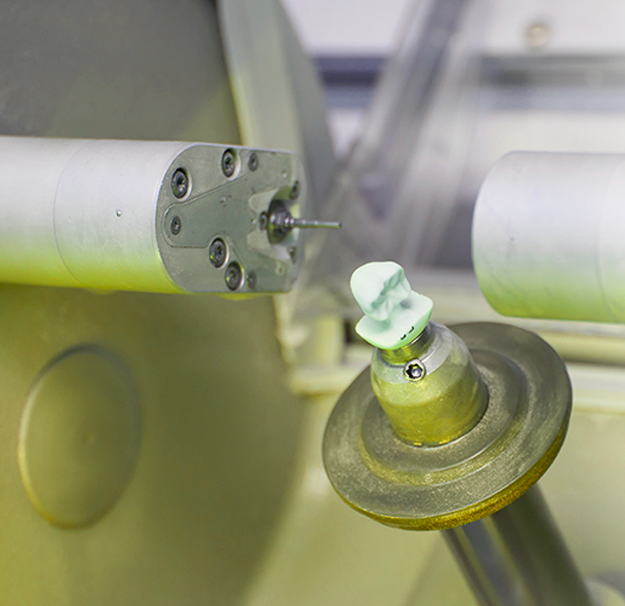 CEREC - Technique de restauration dentaire - Clinique de santé dentaire Tammy Raymond