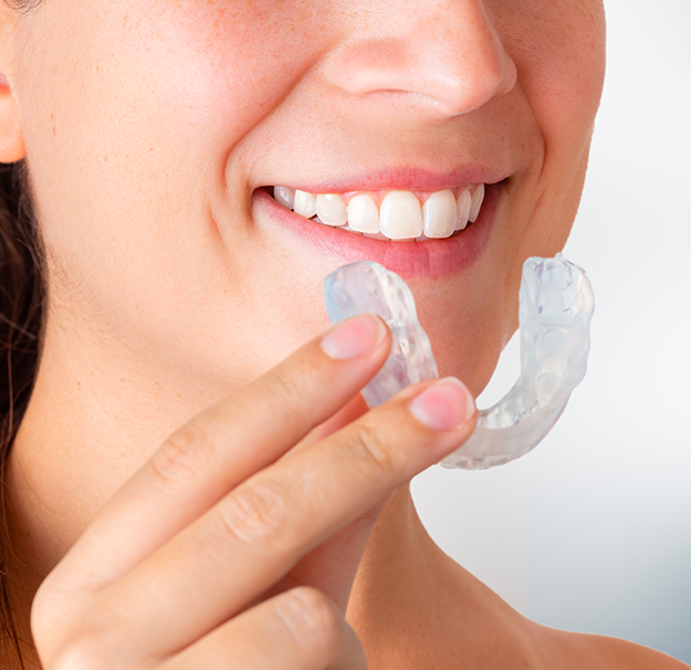 Plaque occlusale - Problème de machoire - Bruxime - Grincement des dents - Clinique de santé dentaire Tammy Raymond