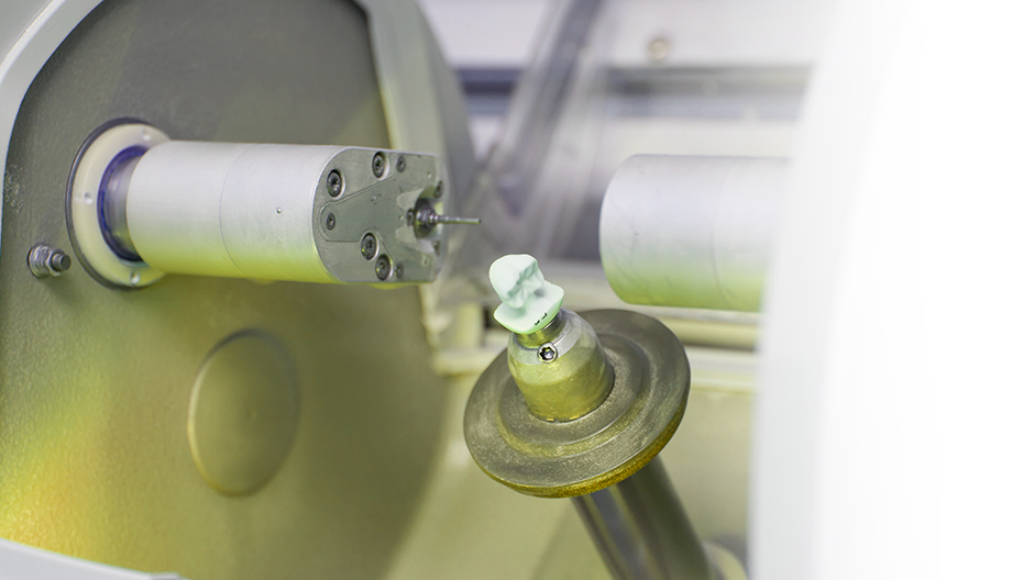 CEREC - Technique de restauration dentaire - Clinique de santé dentaire Tammy Raymond