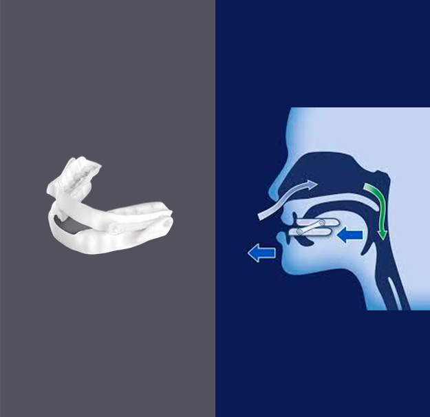 Orthodontie - Traitement d'avancement mandibulaire - Bruxisme - Ronflement - Clinique de santé dentaire Tammy Raymond de Terrebonne